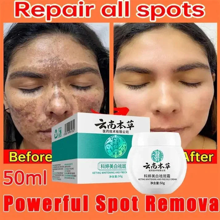 Dark Spot Corrector Skin Whitening Cream